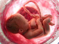 Thumbnail for version as of 10:44, 4 March 2017